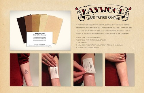 Tattoo Removal Business Card Tattoo Removal Business Card